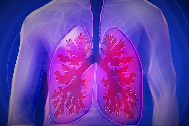 Lungenerkrankung Alpha-1-Antitrypsinmangel Ein männlicher Oberkörper zeigt die Lunge, um auf die Alpha-1-Antitrypsinmangel hinzuweisen, welche die Lunge zerstören kann.